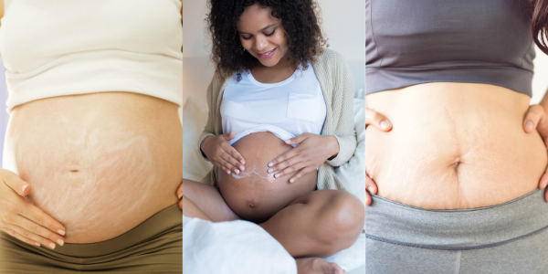 skin care during pregnancy and beyond